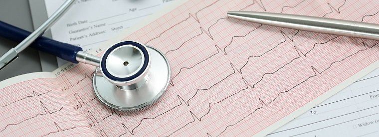 heart-palpitations-blog