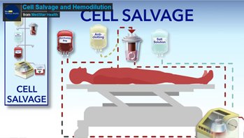 Bloodless medicine