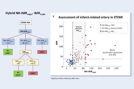 Scientific slide with a flowchart and a scatter plot comparing measurements related to an infarct-related artery in STEMI patients.