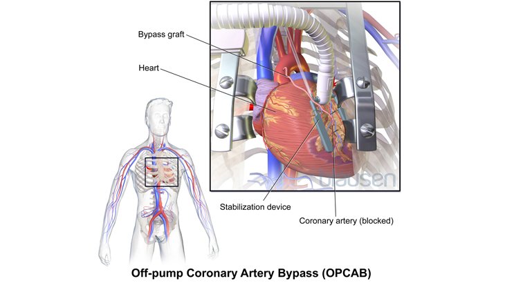 3d Illustration of heart